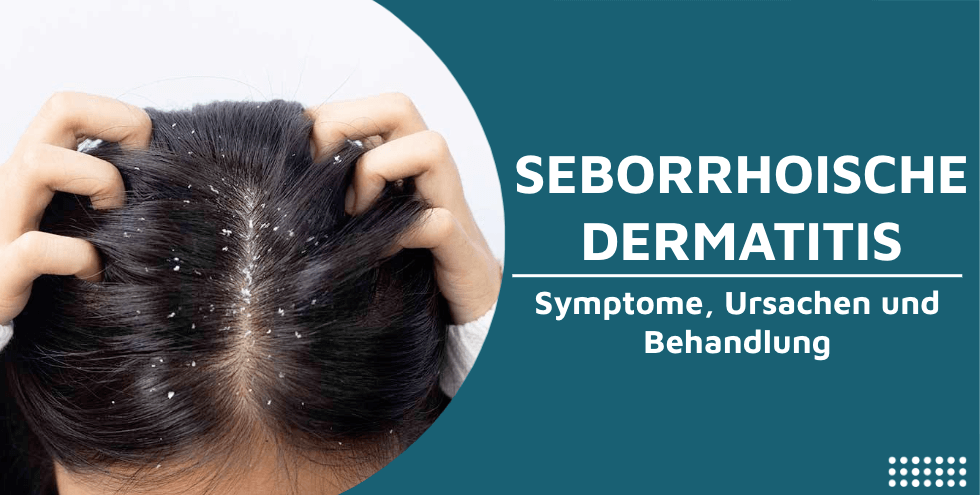 Was ist seborrhoische Dermatitis Symptome Ursachen Behandlung Titelbild