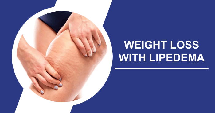 Effective-Weight-Loss-With-Lipedema