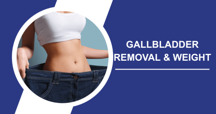 Safe-Healthy-Weight-Loss-After-Gallbladder-Removal-